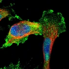 Immunofluorescent staining of human cell line U-251 MG shows localization to nucleoplasm, plasma membrane & cytosol.