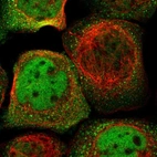 Immunofluorescent staining of human cell line A-431 shows localization to nucleoplasm & cytosol.