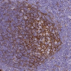 Immunohistochemical staining of human tonsil shows strong membranous positivity in germinal center cells.