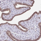 Immunohistochemical staining of human Fallopian tube shows moderate nuclear positivity in glandular cells.
