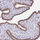 Anti-GLIS3 Antibody
