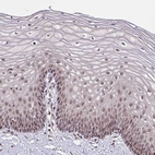 Immunohistochemical staining of human cervix shows weak nuclear positivity in squamous epithelial cells.