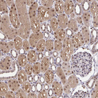 Anti-GLIS3 Antibody