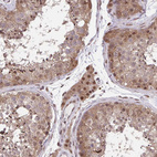 Anti-GLIS3 Antibody