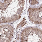 Immunohistochemical staining of human testis shows moderate nuclear positivity in Leydig cells.