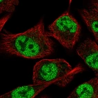 Immunofluorescent staining of human cell line A549 shows localization to nucleoplasm.