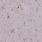 Immunohistochemical staining of human cerebral cortex shows moderate membranous positivity in microglia.
