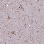 Immunohistochemical staining of human cerebral cortex shows moderate membranous positivity in microglia.