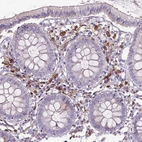 Immunohistochemical staining of human colon shows moderate membranous positivity in lymphoid cells.