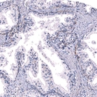 Immunohistochemical staining of human prostate shows weak to moderate positivity in basement membrane of glandular cells.