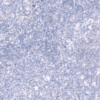 Immunohistochemical staining of human tonsil shows no positivity in non-germinal center cells as expected.