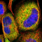 Immunofluorescent staining of human cell line A-431 shows localization to endoplasmic reticulum.