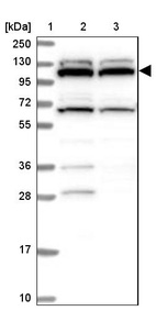Anti-RNF111 Antibody