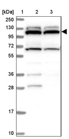 Anti-RNF111 Antibody
