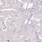 Immunohistochemical staining of human skeletal muscle shows no positivity in striated muscle fibers as expected.