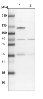 Lane 1: NIH-3T3 cell lysate (Mouse embryonic fibroblast cells)_br/_Lane 2: NBT-II cell lysate (Rat Wistar bladder tumour cells)