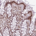 Immunohistochemical staining of human colon shows strong nuclear positivity in glandular cells.