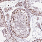 Immunohistochemical staining of human testis shows strong nuclear positivity in spermatogonia.