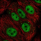 Immunofluorescent staining of human cell line MCF7 shows localization to nucleoplasm & vesicles.