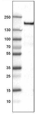 Lane 1: Marker [kDa]_br/_Lane 2: Human tonsil