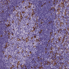 Immunohistochemical staining of human tonsil shows strong membranous positivity in a subset of germinal and non-germinal center cells.