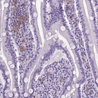 Immunohistochemical staining of human small intestine shows moderate positivity in a subset of lymphoid cells.
