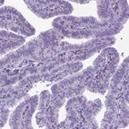 Immunohistochemical staining of human fallopian tube shows moderate membranous positivity in a subset of lymphoid cells.