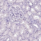 Immunohistochemical staining of human kidney shows no positivity as expected.