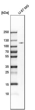 Anti-HK2 Antibody