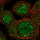 Immunofluorescent staining of human cell line A-431 shows localization to nucleoplasm & the Golgi apparatus.
