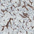Anti-ENG Antibody
