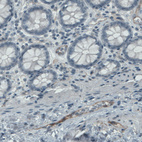 Immunohistochemical staining of human colon shows moderate positivity in the endothelium of blood vessels.