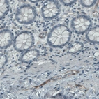 Immunohistochemical staining of human colon shows moderate positivity in the endothelium of blood vessels.
