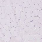 Immunohistochemical staining of human skeletal muscle shows no positivity in myocytes as expected.