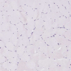 Anti-SPRR4 Antibody