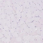 Immunohistochemical staining of human skeletal muscle shows no positivity in myocytes as expected.