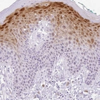 Immunohistochemical staining of human skin shows strong cytoplasmic-nucleus positivity in squamous epithelial cells.