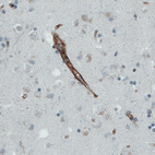 Immunohistochemical staining of human cerebral cortex shows strong immunoreactivity in the blood vessels.