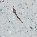 Immunohistochemical staining of human cerebral cortex shows strong immunoreactivity in the blood vessels.