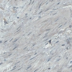 Immunohistochemical staining of smooth muscle shows absence of positivity in myocytes (negative control).