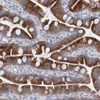 Immunohistochemical staining of human small intestine shows strong cytoplasmic positivity in glandular cells.