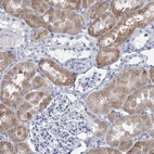 Immunohistochemical staining of human kidney shows moderate cytoplasmic positivity in cells in tubules.