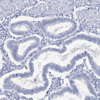 Immunohistochemical staining of human endometrium shows no positivity in glandular cells as expected.
