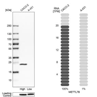 Western blot analysis in human cell lines Caco-2 and A-431 using Anti-METTL7B antibody. Corresponding METTL7B RNA-seq data are presented for the same cell lines. Loading control: Anti-PARP1.