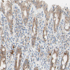 Immunohistochemical staining of human rectum shows moderate cytoplasmic positivity in glandular cells.
