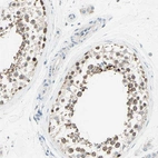 Immunohistochemical staining of human testis shows strong cytoplasmic positivity in cells in seminiferous ducts.