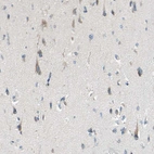 Immunohistochemical staining of human cerebral cortex shows moderate cytoplasmic positivity in neurons.