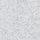 Immunohistochemical staining of human liver shows no positivity in hepatocytes as expected.