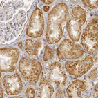 Immunohistochemical staining of human kidney shows strong cytoplasmic positivity in cells in tubules.