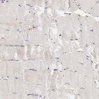 Immunohistochemical staining of human skeletal muscle shows no positivity in myocytes as expected.